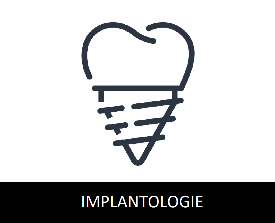 implants dentaires Nimes